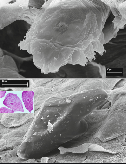 Reflectance confocal microscopy enabling full viewing of Demodex sp. – Ribeiro – – International Journal of Dermatology – Wiley Online Library
