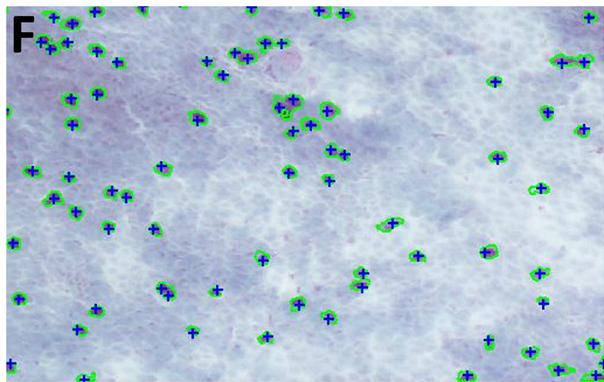 Regional Comparison of Goblet Cell Number and Area in Exposed and Covered Dry Eyes and Their Correlation with Tear MUC5AC
