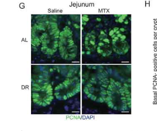 Dietary restriction increases protective gut bacteria to rescue lethal methotrexate-induced intestinal toxicity