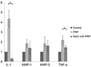Effects of Platelet-rich Plasma on Ocular Surface in Patients with Dry Eye Syndrome: Clinico-experimental Analysis