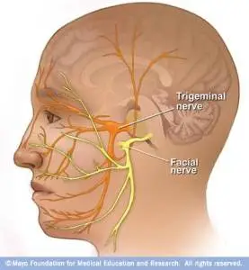 Changes in brainstem excitatory and inhibitory pathways in dry eye syndrome